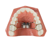 palatal expander model