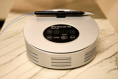 Laser Treatment